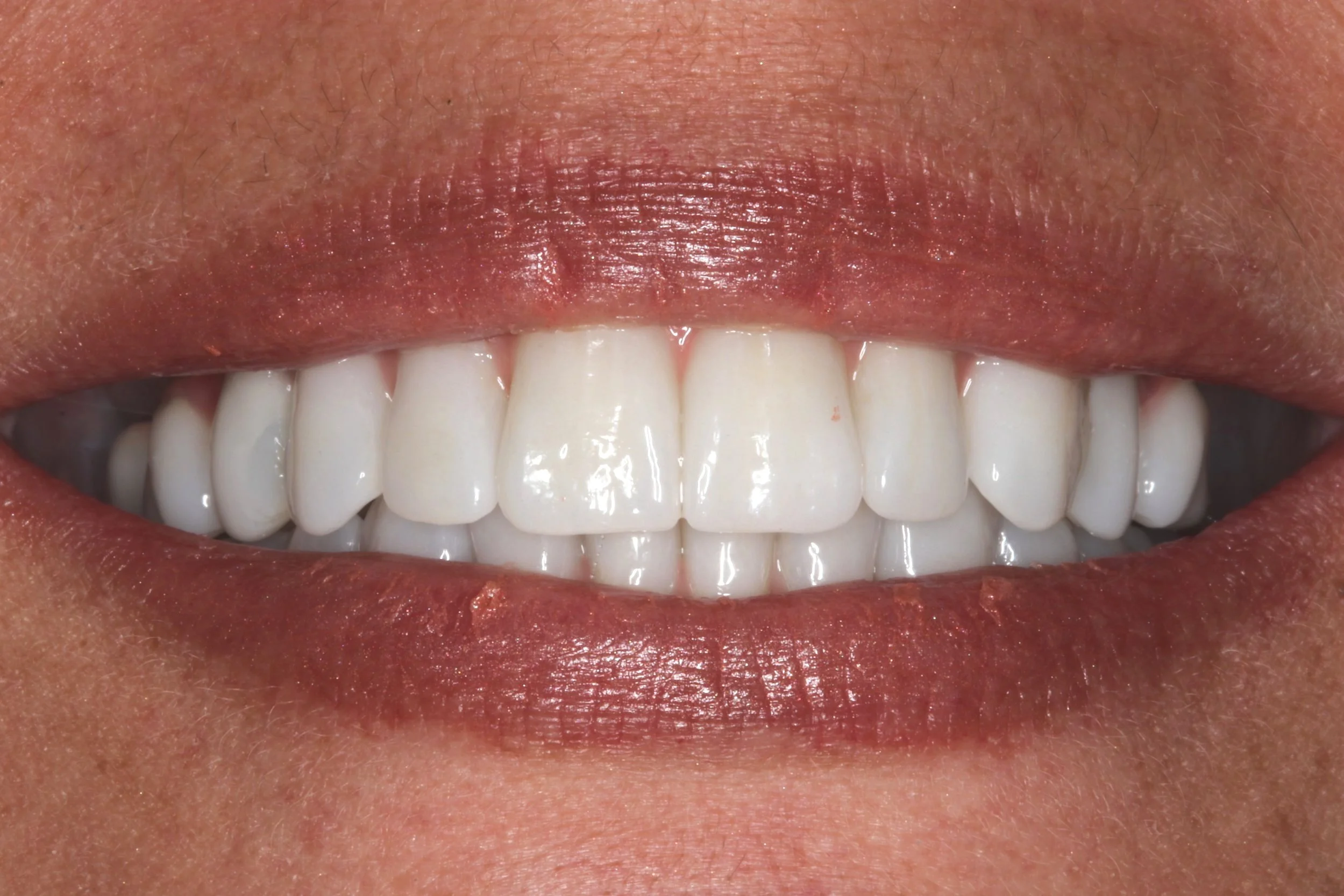 David Zelby DDS - Custom Dentures — Dr. David Zelby